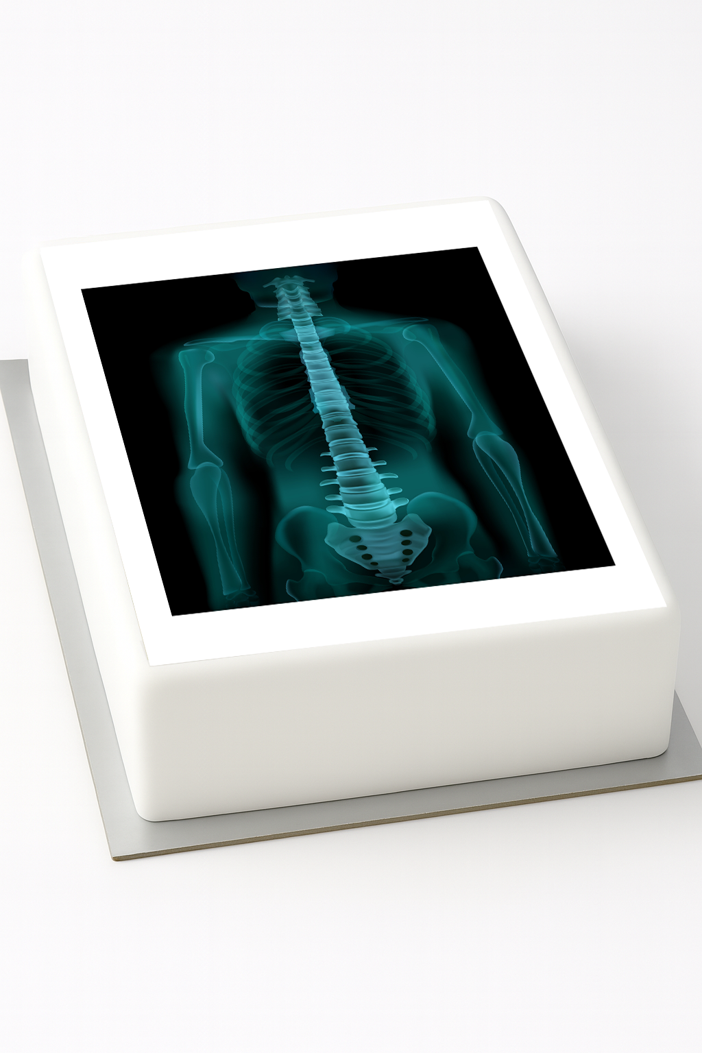 Tortenaufleger Röntgenbild